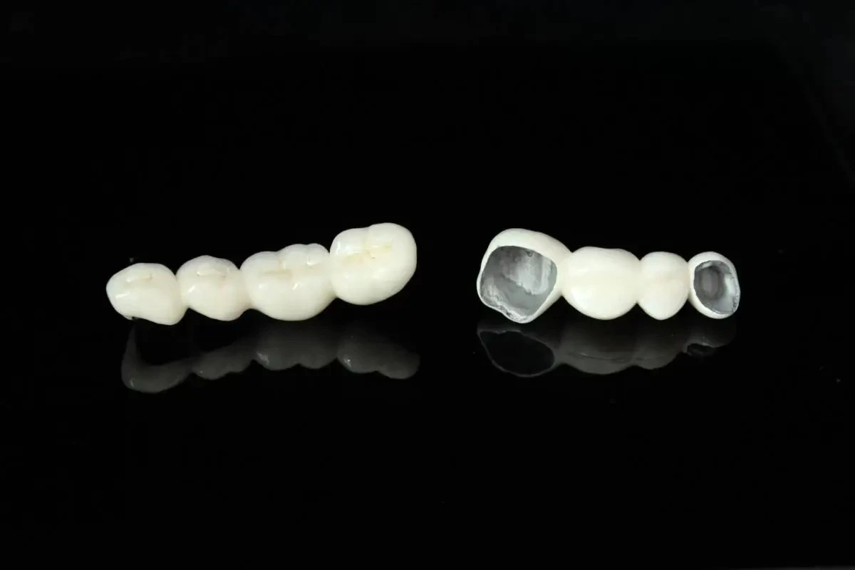 Metal Ceramic Classic