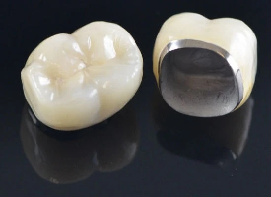 Fixed Restorations (Crowns & Bridges)