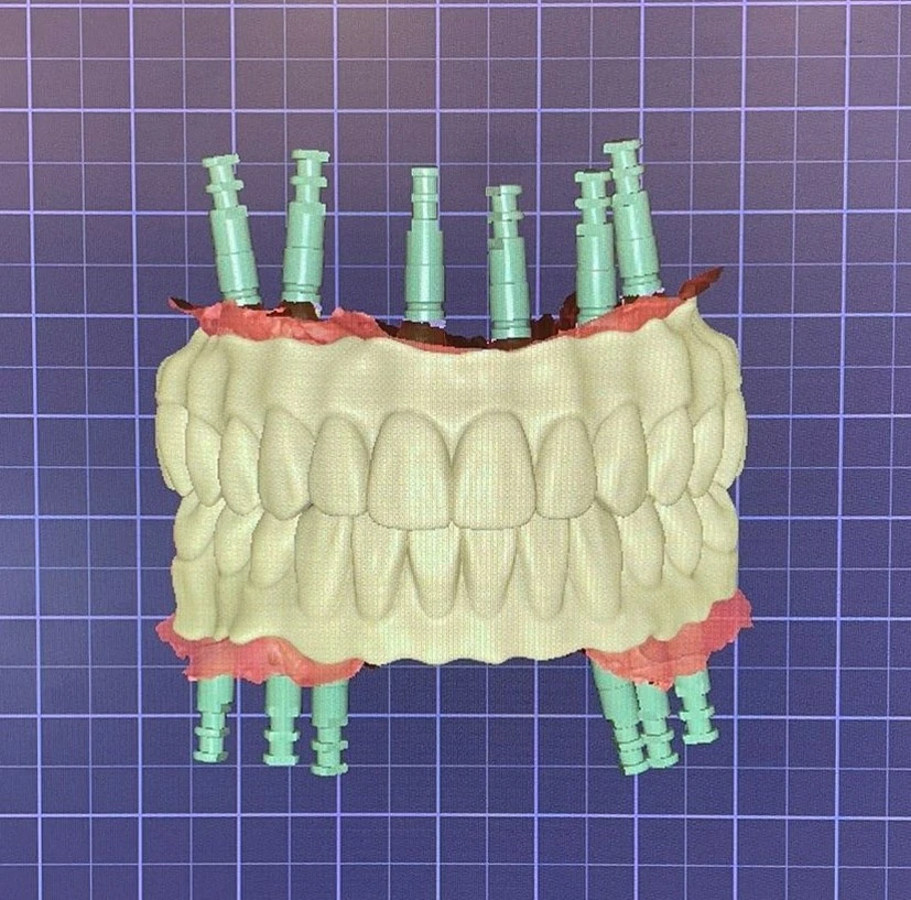 Digital Dental Workflow