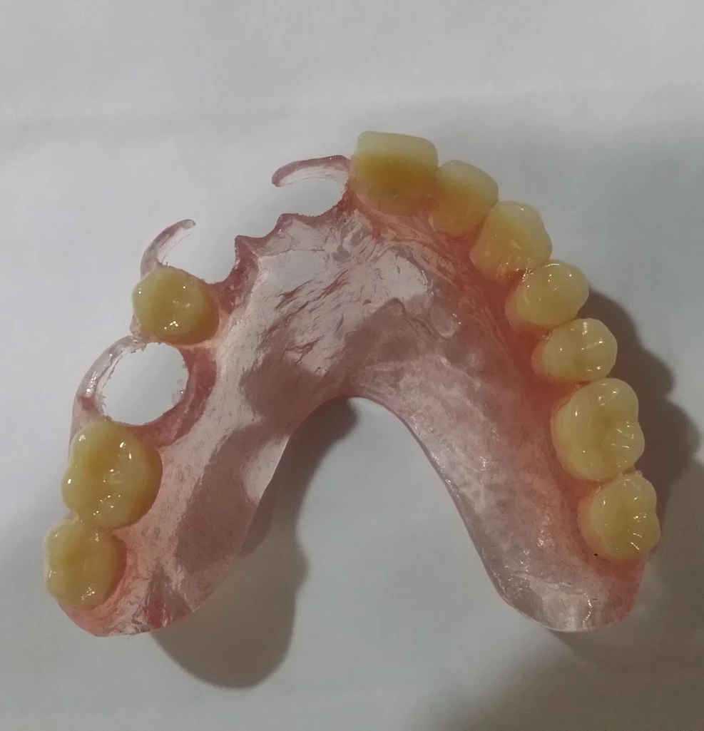 Partial dentures for missing teeth