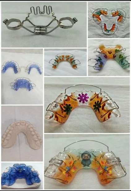 Custom-designed Hawley retainer